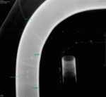 radiografia industrial pelicula radiografica